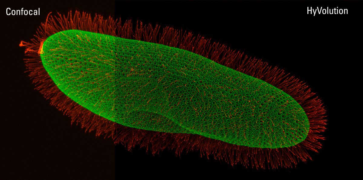 csm_9_Paramecium_Vergleich_a6cfddddde.jp