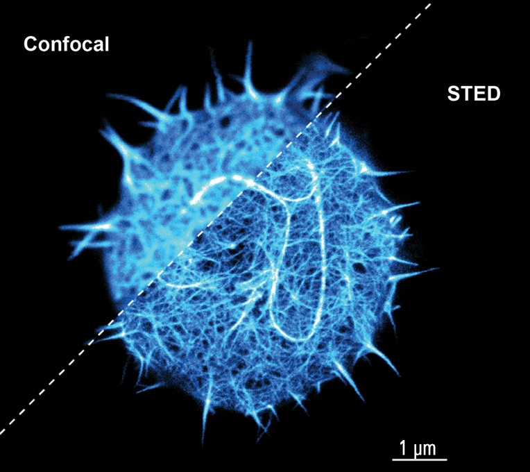 Obr. 2: porovnání konfokální obrázku se STED obrázkem
