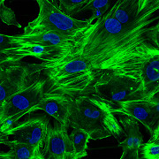 Fixované neonatální kardiomyocyty kultivované na mikroskopické misce označené DAPI a ActinGreen 488.