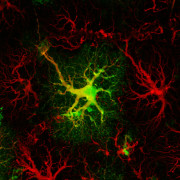 Řez mozku myši exprimující EGFP (Enhanced Green Fluorescent Protein) pod kontrolou GFAP (Glial Fibrillary Acidic Protein) promotoru obarveného protilátkou proti GFAP.