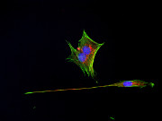 buněčný kontakt  fotografie buněčné osteoblastové linie MC3T3-E1, zeleně aktin (ActinGreen), červeně alfa-tubulin (AlexaFluor 568), modře jádro (DAPI).