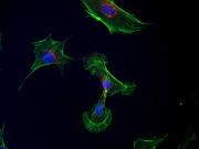 fotografie buněčné osteoblastové linie MC3T3-E1 pořízená přes všechny filtry zároveň (merge) za použití barviv DAPI, AlexaFluor 488 a AlexaFluor 568
