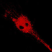 Mesenchymal Stromal Cells (MSCs) obarvené pomoci SPIO-Rhodamine nanočásticemi, které jsou navázané na lysozomy a mitochondrie. 3D.