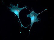dělení podle pravítka  fotografie buněčné osteoblastové linie MC3T3-E1, zeleně aktin (ActinGreen), červeně alfa-tubulin (AlexaFluor 568), modře jádro (DAPI).