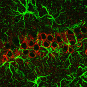 Řez mozku myši, triple transgenního modelu Alzheimerovy choroby, obarvený protilátkami proti amyloidu β (Aβ) a GFAP (Glial Fibrillary Acidic Protein). Na obrázku jsou zobrazeny pyramidální neurony v CA1 oblasti hipokampu s intracelulárními ložisky Aβ obklopenými astrocytárními výběžky.