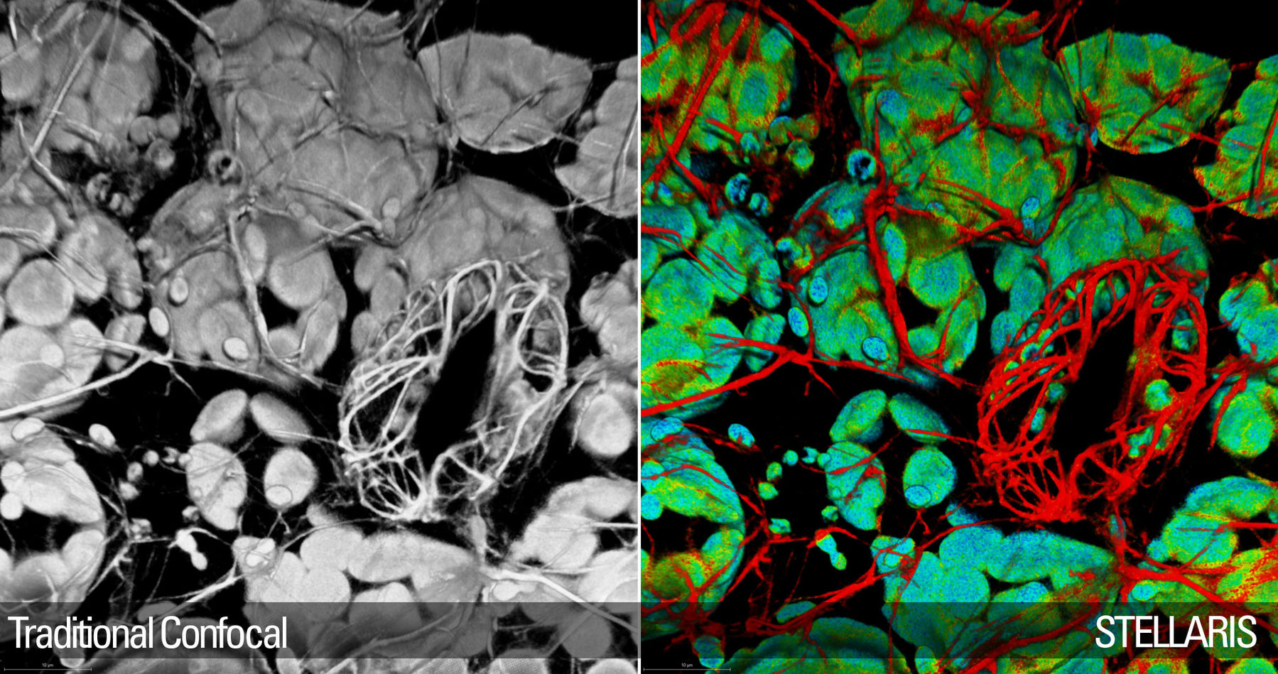 csm_Arabidopsis-Thaliana-leaf-w_e42a5bd7