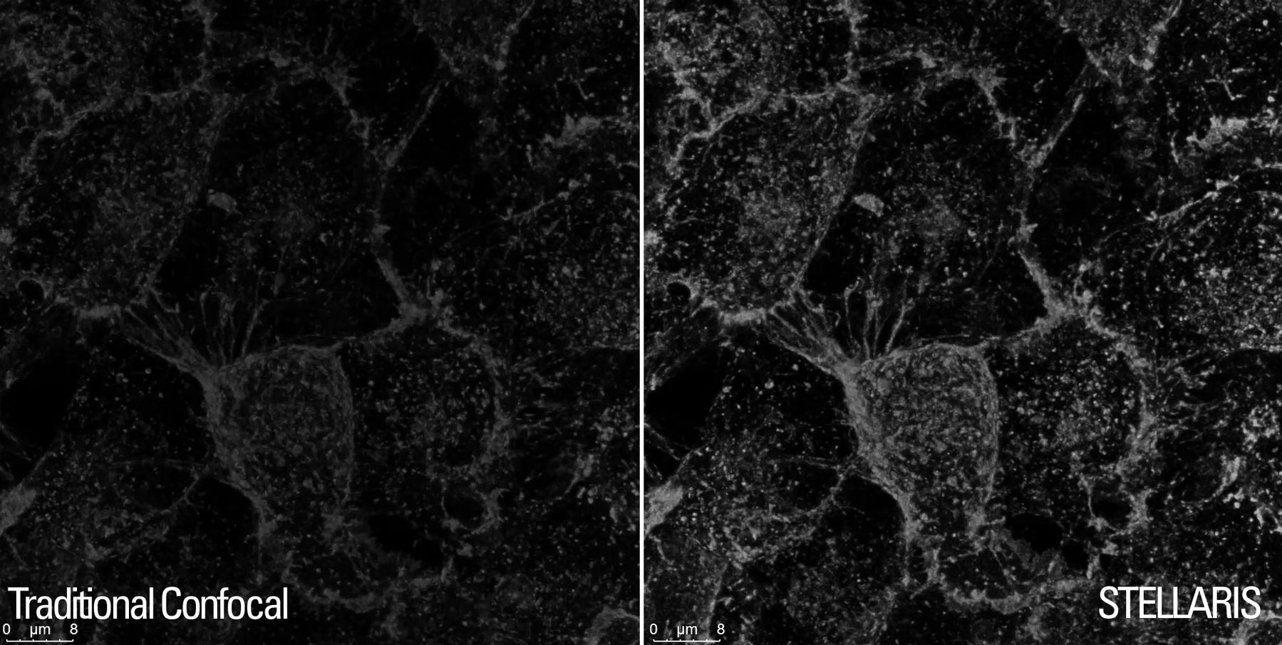 csm_detectors-hela-cell2_64c91bc782.jpg