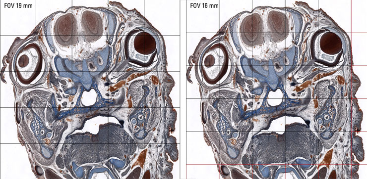 Large FOV