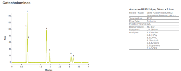 Obr.%201%20Anal%C3%BDza%20katecholamin%C