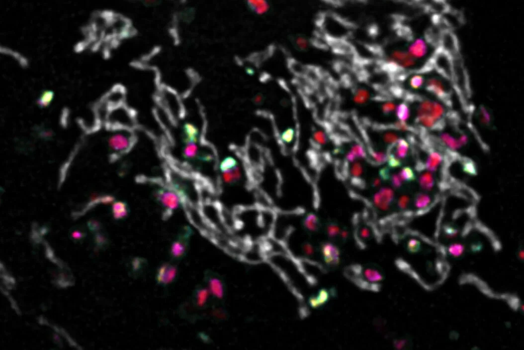 csm_Endocytic-Vesicles-Webinar_8fb01c021